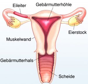 Scheideneingang knubbel im Vaginalkarzinom, Scheidenkarzinom,